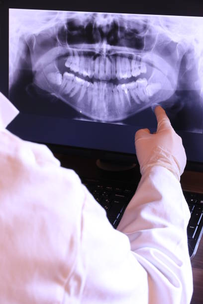 Best Emergency Treatment for Dental Infections or Abscesses in Arnold Line, MS